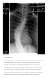 thumnail for https:_medicalhealthhumanities_com_2017_11_28_disorientations_11_7_2023_6_10_34_AM.pdf