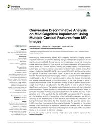thumnail for Guo et al. - 2017 - Conversion Discriminative Analysis on Mild Cogniti.pdf